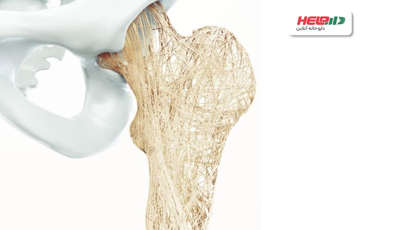 پوکی استخوان چه تأثیری در سلامت فردی دارد؟