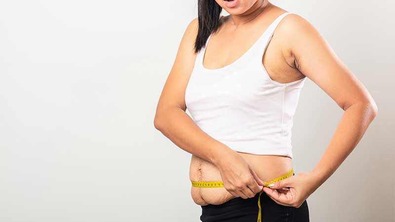 روش های کاهش وزن پس از بارداری روش های کاهش وزن پس از بارداری