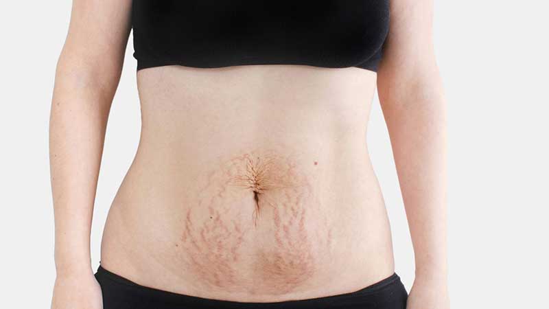 برنامه های غذایی اصولی برای کاهش وزن بعد از بارداری برنامه های غذایی اصولی برای کاهش وزن بعد از بارداری