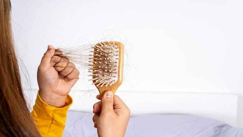 ریزش مو ریزش مو