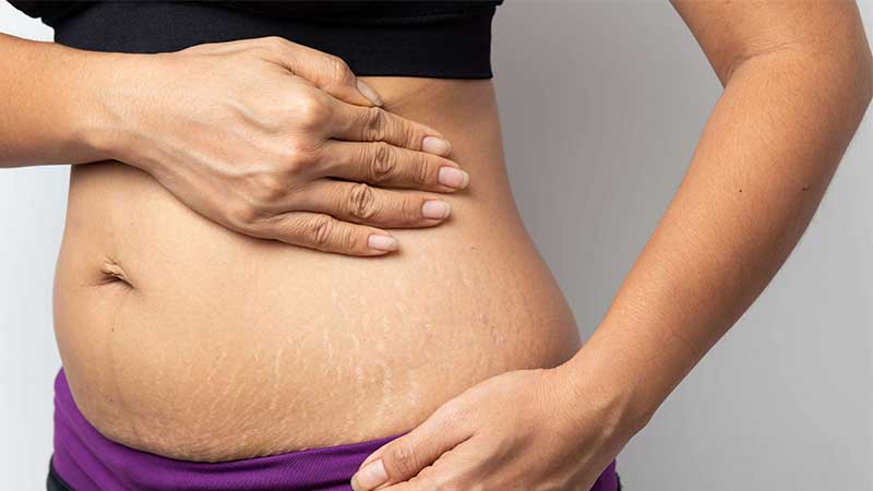 چند غذای رژیمی مناسب برای شمایی که قصد لاغر شدن دارید! چند غذای رژیمی مناسب برای شمایی که قصد لاغر شدن دارید!