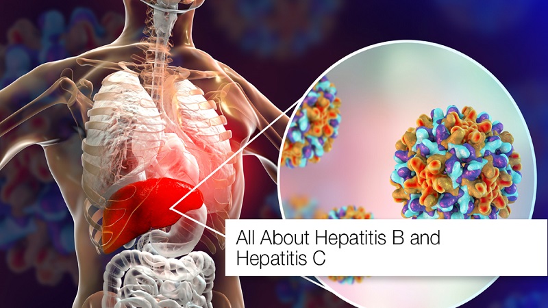 هپاتیت B و C  (Hepatitis B and C)